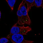 Atlas Antibodies Anti-MAN2A2 Antibody