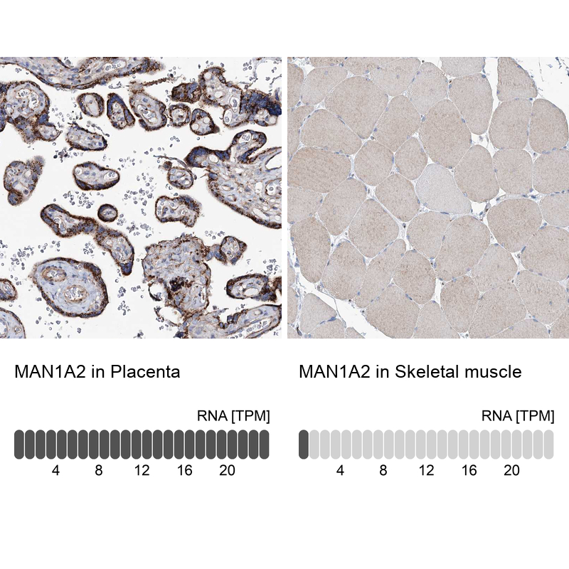 Atlas Antibodies Anti-MAN1A2 Antibody