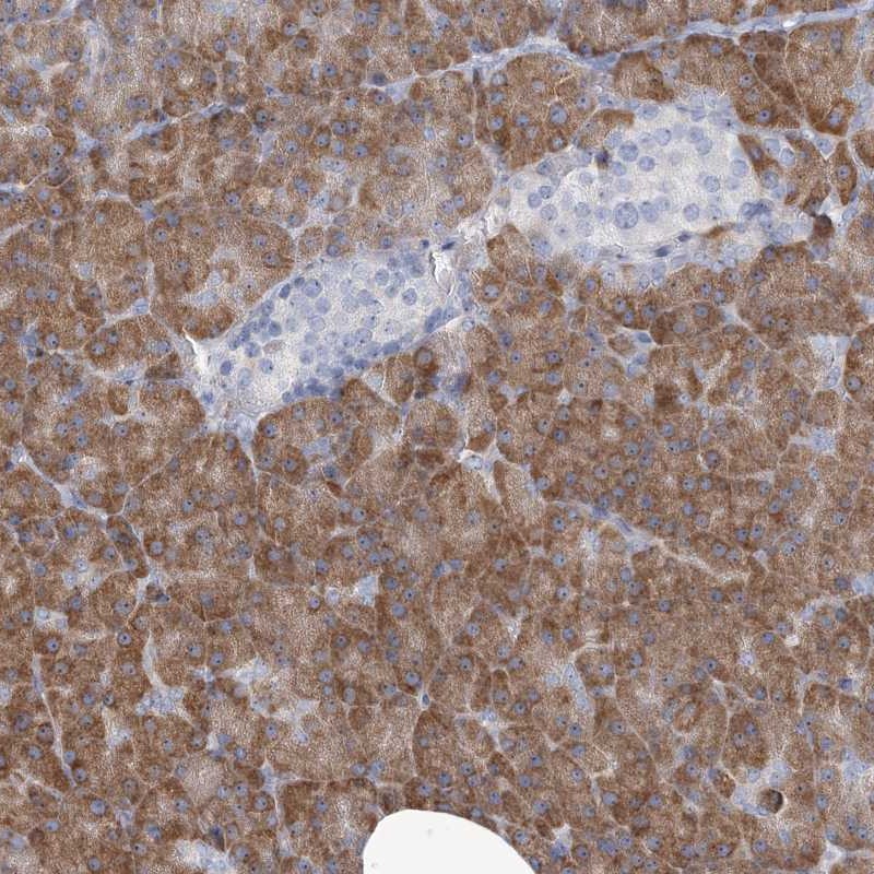Atlas Antibodies Anti-MAN2B2 Antibody