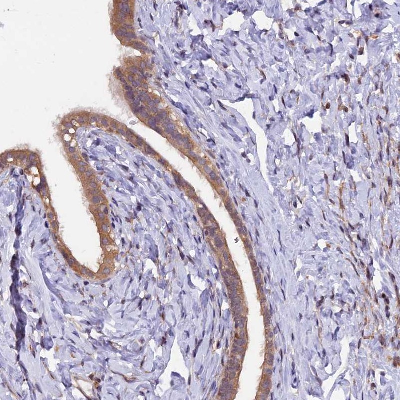 Atlas Antibodies Anti-MAN2C1 Antibody