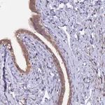 Atlas Antibodies Anti-MAN2C1 Antibody