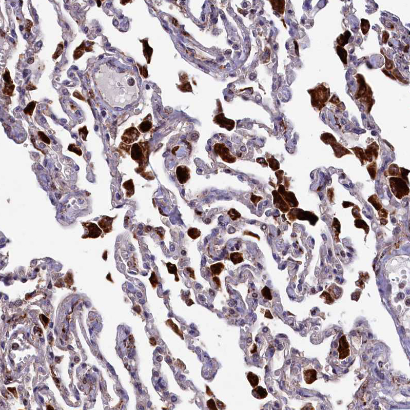 Atlas Antibodies Anti-MAN2B1 Antibody