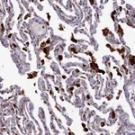 Atlas Antibodies Anti-MAN2B1 Antibody
