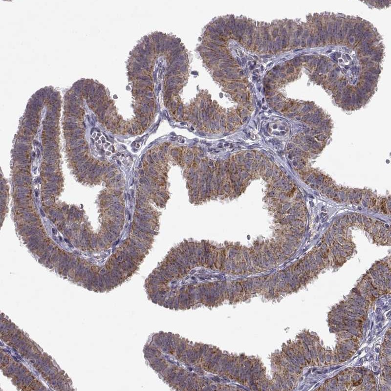 Atlas Antibodies Anti-MANBAL Antibody