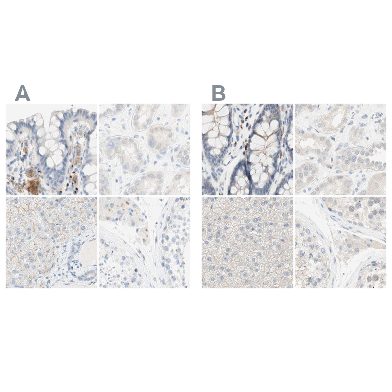 Atlas Antibodies Anti-MANEA Antibody