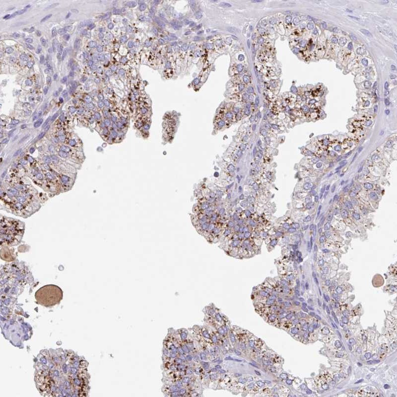 Atlas Antibodies Anti-MANBA Antibody