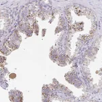 Atlas Antibodies Anti-MANBA Antibody