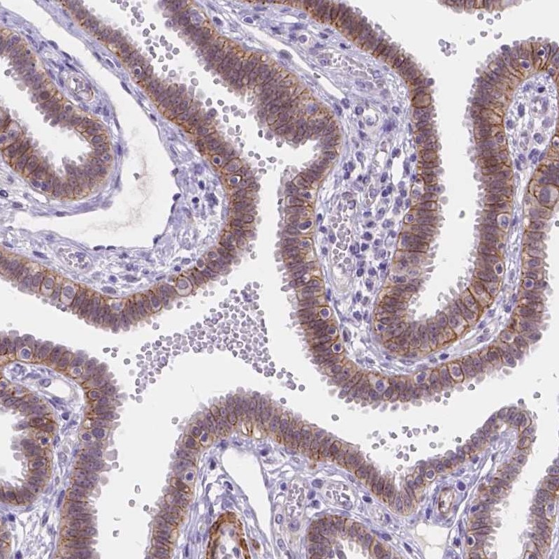 Atlas Antibodies Anti-MAN2C1 Antibody
