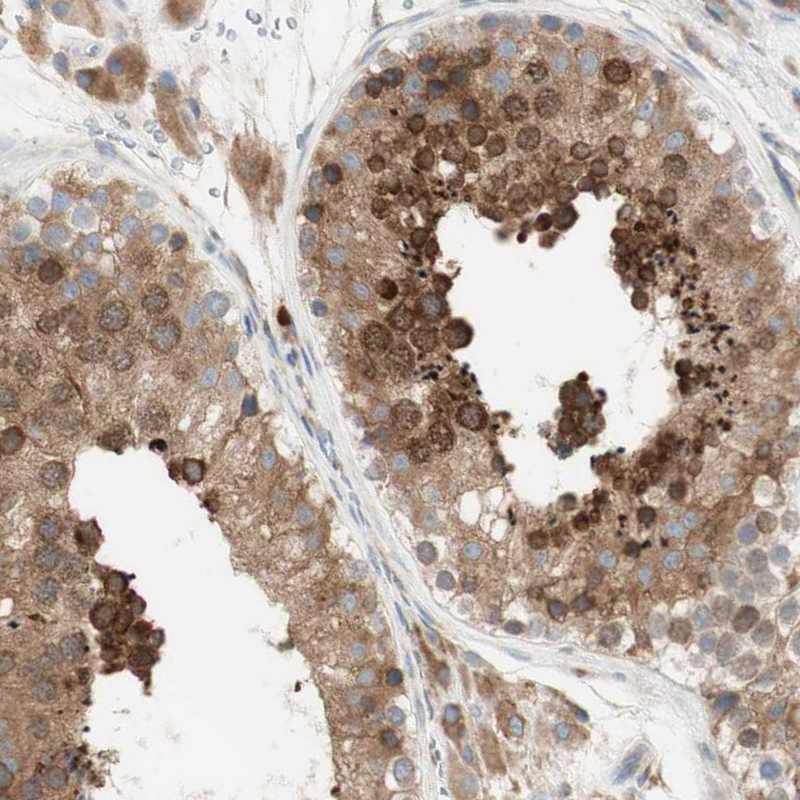 Atlas Antibodies Anti-MANF Antibody
