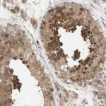 Atlas Antibodies Anti-MANF Antibody