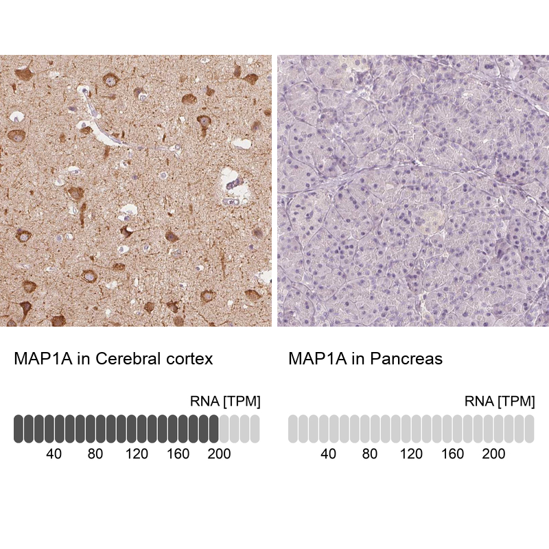 Atlas Antibodies Anti-MAP1A Antibody