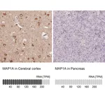 Atlas Antibodies Anti-MAP1A Antibody