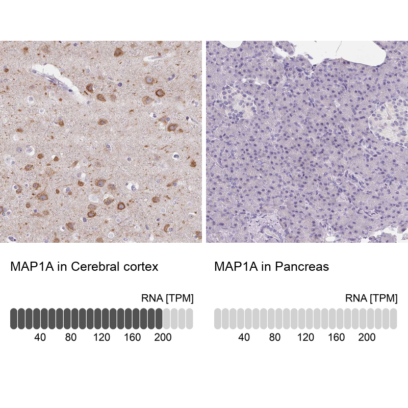Atlas Antibodies Anti-MAP1A Antibody