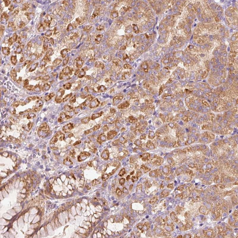 Atlas Antibodies Anti-MAP10 Antibody