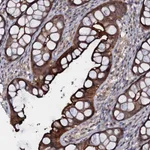 Atlas Antibodies Anti-MANSC4 Antibody