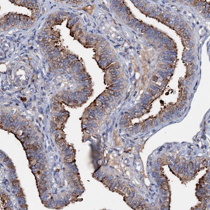 Atlas Antibodies Anti-MANSC4 Antibody