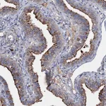 Atlas Antibodies Anti-MANSC4 Antibody