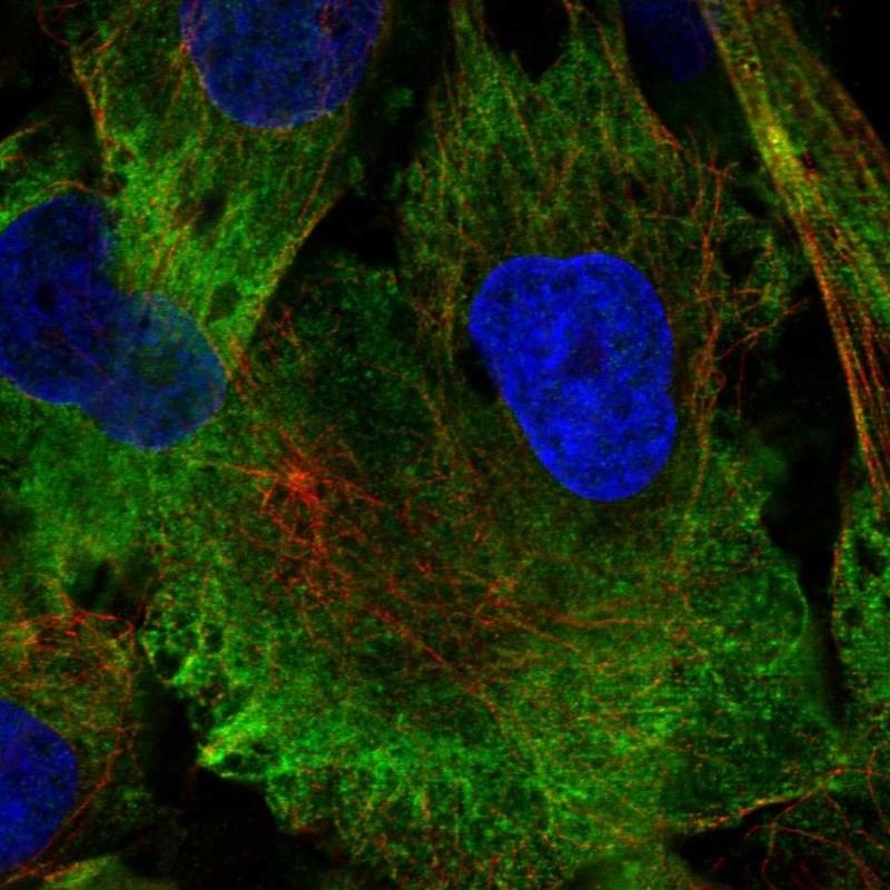 Atlas Antibodies Anti-MAP1A Antibody