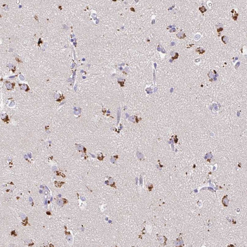 Atlas Antibodies Anti-MAP1LC3A Antibody