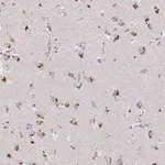Atlas Antibodies Anti-MAP1LC3A Antibody