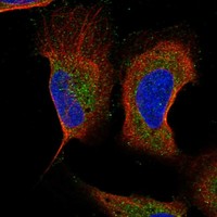 Atlas Antibodies Anti-MAP1LC3B Antibody