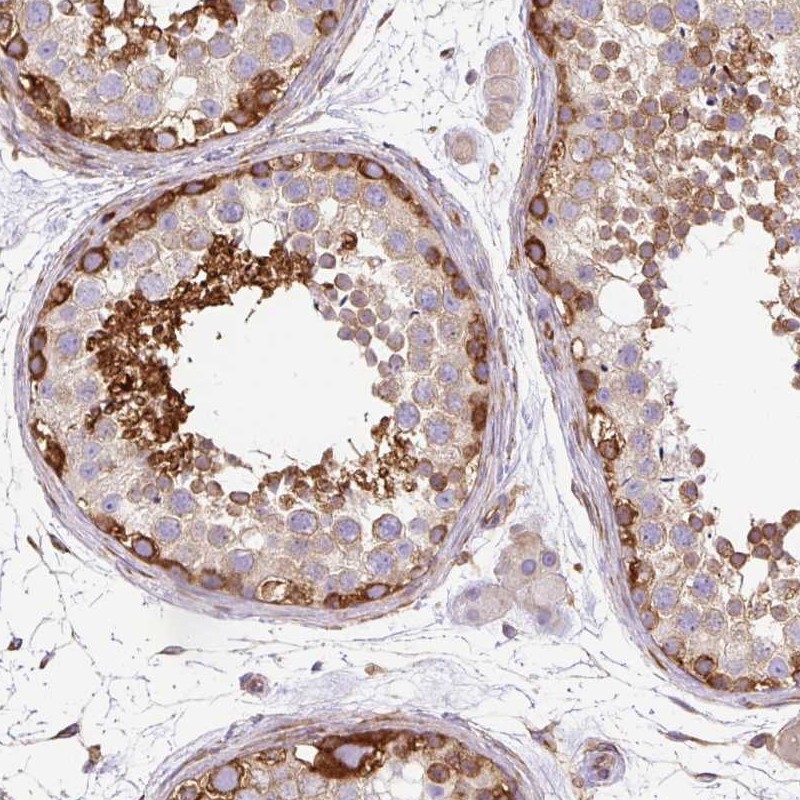 Atlas Antibodies Anti-MAP1S Antibody