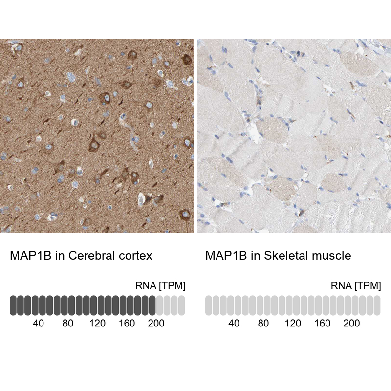 Atlas Antibodies Anti-MAP1B Antibody