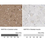 Atlas Antibodies Anti-MAP1B Antibody