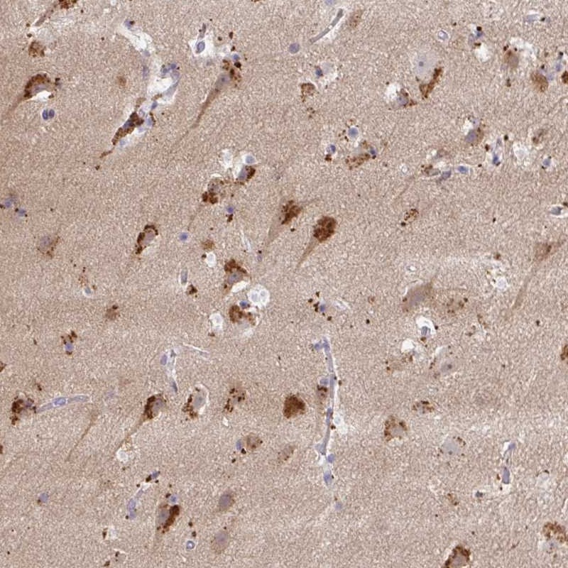 Atlas Antibodies Anti-MAP1LC3A Antibody