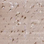 Atlas Antibodies Anti-MAP1LC3A Antibody