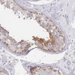 Atlas Antibodies Anti-MAP1S Antibody