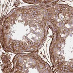 Atlas Antibodies Anti-MAP1LC3B Antibody