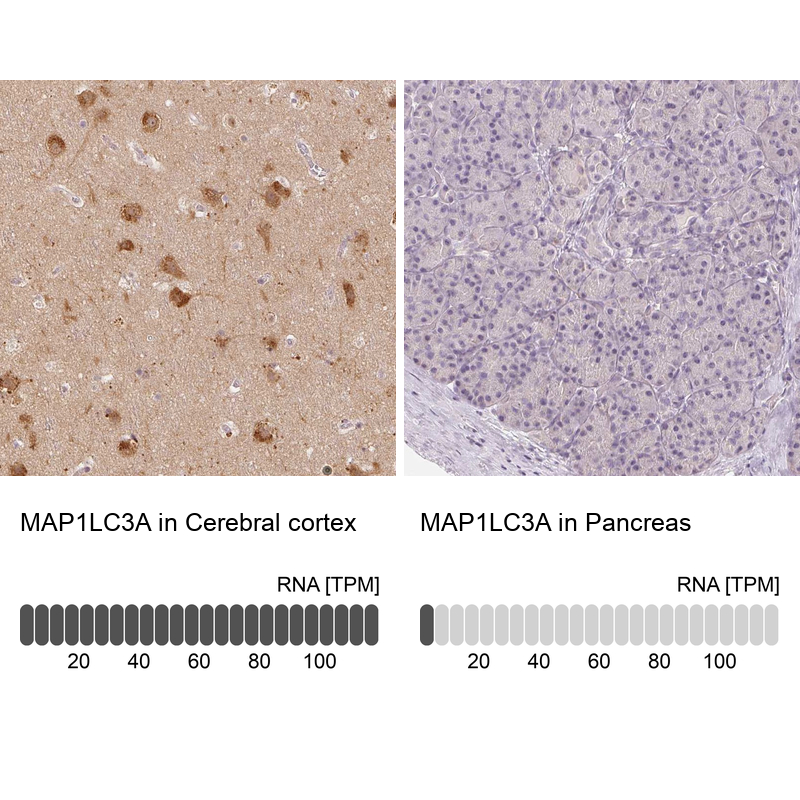 Atlas Antibodies Anti-MAP1LC3A Antibody