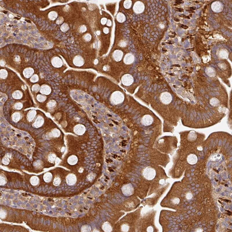 Atlas Antibodies Anti-MAP2K2 Antibody