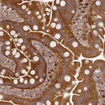 Atlas Antibodies Anti-MAP2K2 Antibody