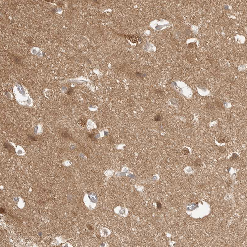Atlas Antibodies Anti-MAP2K1 Antibody