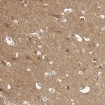 Atlas Antibodies Anti-MAP2K1 Antibody
