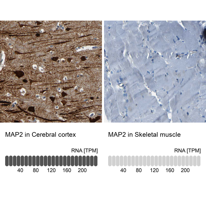 Atlas Antibodies Anti-MAP2 Antibody