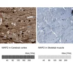 Atlas Antibodies Anti-MAP2 Antibody