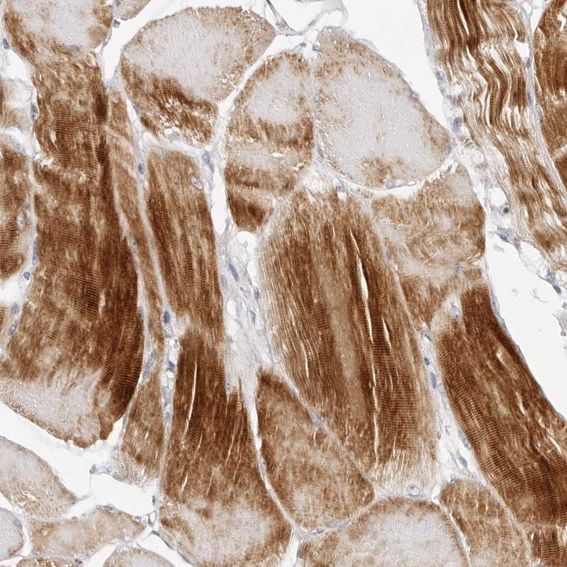 Atlas Antibodies Anti-MAP2K5 Antibody