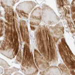 Atlas Antibodies Anti-MAP2K5 Antibody