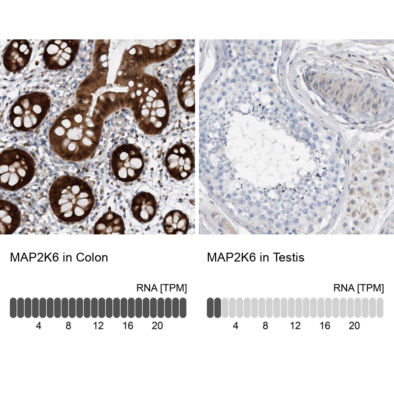 Atlas Antibodies Anti-MAP2K6 Antibody