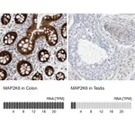 Atlas Antibodies Anti-MAP2K6 Antibody