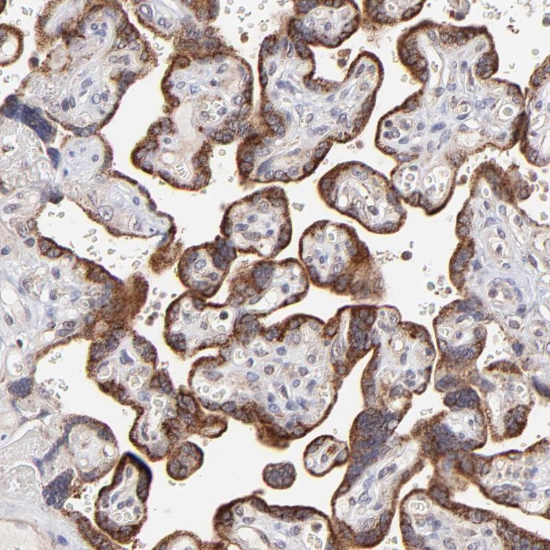 Atlas Antibodies Anti-MAP2K7 Antibody
