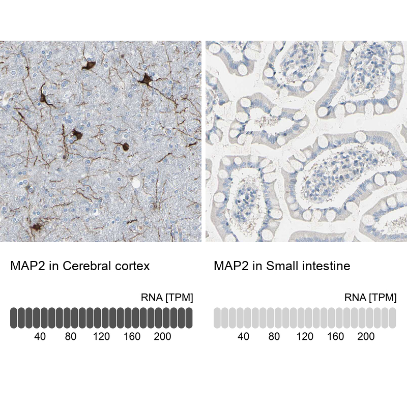 Atlas Antibodies Anti-MAP2 Antibody