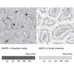 Atlas Antibodies Anti-MAP2 Antibody