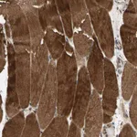 Atlas Antibodies Anti-MAP3K10 Antibody