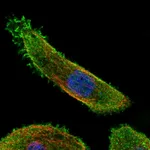 Atlas Antibodies Anti-MAP2K7 Antibody