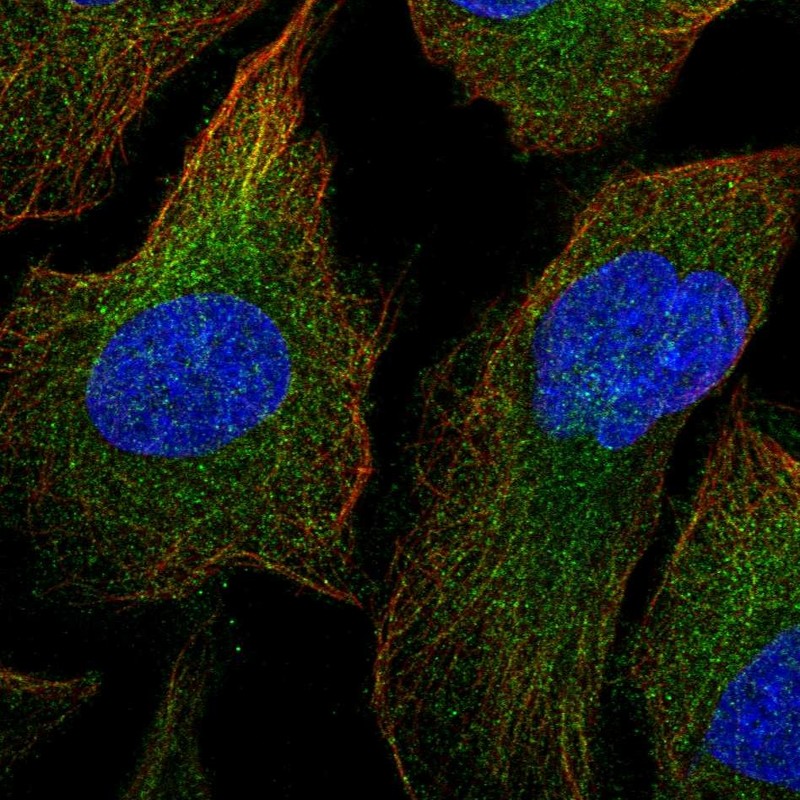 Atlas Antibodies Anti-MAP3K1 Antibody