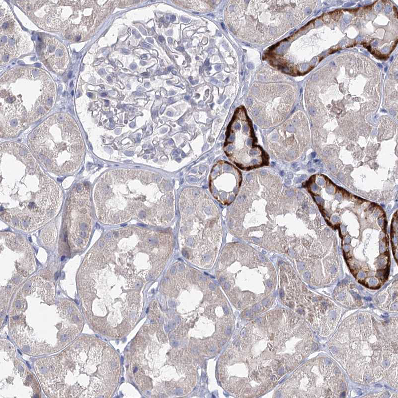 Atlas Antibodies Anti-MAP3K13 Antibody